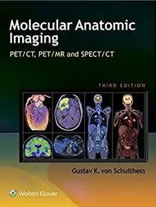 Molecular Anatomic Imaging: PET/CT, PET/MR and SPECT CT, 3rd Edition