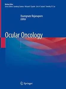 Ocular Oncology (Repost)