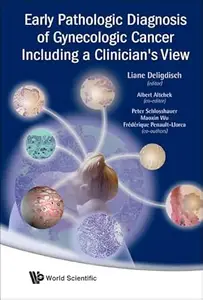 Early Pathologic Diagnosis Of Gynecologic Cancer Including A Clinician's View