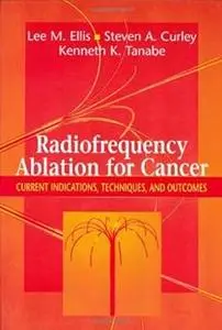 Radiofrequency Ablation for Cancer: Current Indications, Techniques, and Outcomes (Repost)