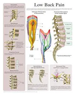 Low Back Pain e-chart: Quick reference guide