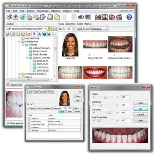 Photodontics Pro 1.0 Build 2240 Portable