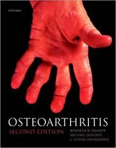 Osteoarthritis
