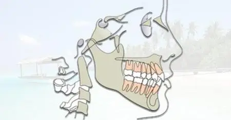 Orthodontic Treatment Planning for dental professionals