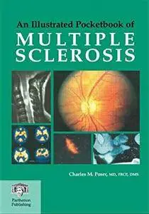 An Illustrated Pocketbook of Multiple Sclerosis