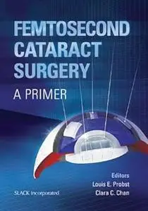 Femtosecond Cataract Surgery: A Primer