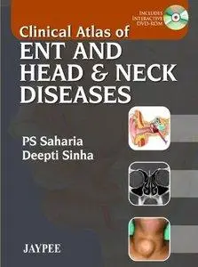 Clinical Atlas of ENT and Head & Neck Diseases (Repost)