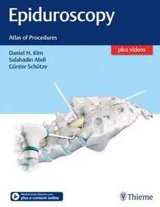 Epiduroscopy : Atlas of Procedures
