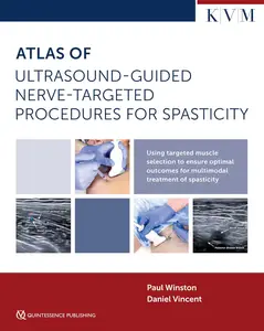 Atlas of Ultrasound-Guided Nerve-Targeted Procedures for Spasticity: Maximizing Outcomes for the Patient with Spasticity