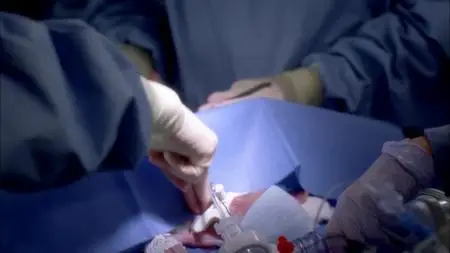 Grey's Anatomy S08E16
