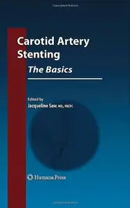 Carotid Artery Stenting