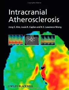 Intracranial Atherosclerosis