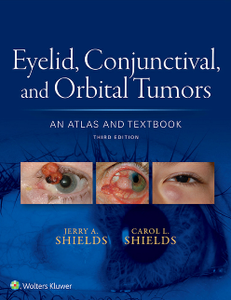 Eyelid, Conjunctival, and Orbital Tumors : An Atlas and Textbook, Third Edition