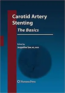 Carotid Artery Stenting: The Basics (Repost)