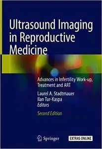 Ultrasound Imaging in Reproductive Medicine: Advances in Infertility Work-up, Treatment and ART Ed 2