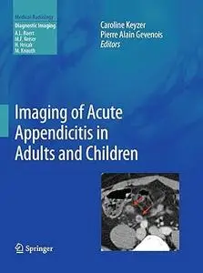 Imaging of Acute Appendicitis in Adults and Children (Repost)