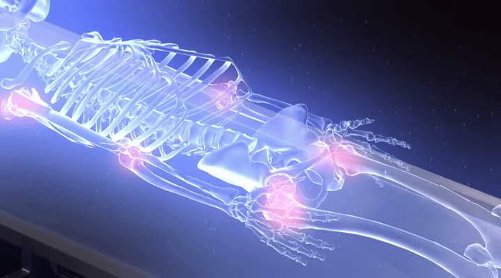 Who Killed the Neanderthal? (2017)