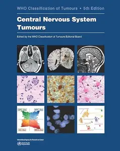 Central Nervous System Tumours: WHO Classification of Tumours (Repost)