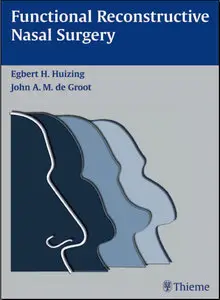 Functional Reconstructive Nasal Surgery (repost)