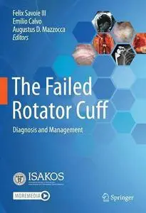 The Failed Rotator Cuff: Diagnosis and Management