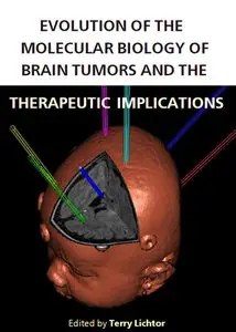 "Evolution of the Molecular Biology of Brain Tumors and the Therapeutic Implications" ed. by Terry Lichtor
