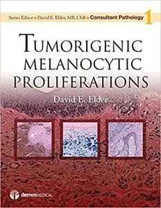 Consultant Pathology: Tumorigenic Melanocytic Proliferations