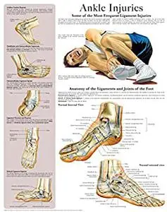 Ankle Injuries e-chart: Quick reference guide