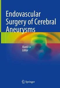 Endovascular Surgery of Cerebral Aneurysms (Repost)