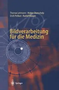 Bildverarbeitung für die Medizin: Grundlagen, Modelle, Methoden, Anwendungen