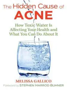 The Hidden Cause of Acne: How Toxic Water Is Affecting Your Health and What You Can Do about It, 2nd Edition