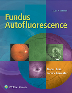 Fundus Autofluorescence, Second Edition
