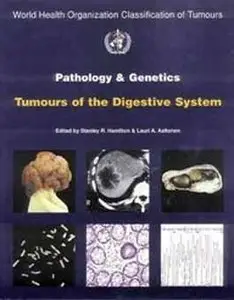 Pathology and Genetics of Tumours of the Digestive System by The International Agency for Research on Cancer