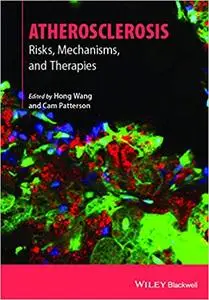 Atherosclerosis: Risks, Mechanisms, and Therapies