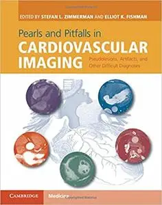 Pearls and Pitfalls in Cardiovascular Imaging: Pseudolesions, Artifacts, and Other Difficult Diagnoses (Repost)