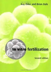 In Vitro Fertilization