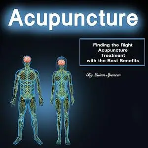 «Acupuncture» by Spencer Quinn