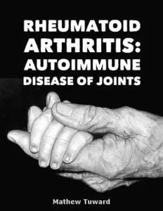 «Rheumatoid Arthritis: Autoimmune Disease of Joints» by Mathew Tuward