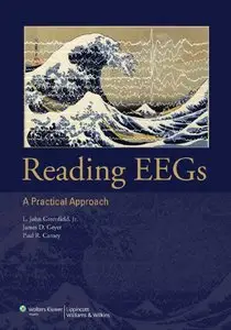 Reading EEGs: A Practical Approach (repost)