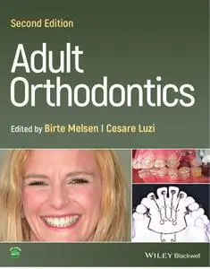 Adult Orthodontics, 2nd Edition