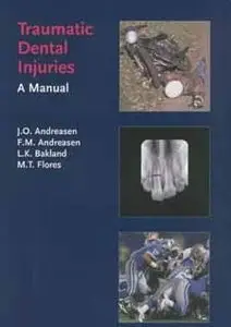 Traumatic Dental Injuries: A Manual [Repost]