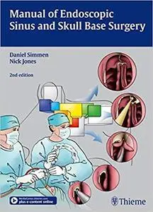 Manual of Endoscopic Sinus and Skull Base Surgery 2nd edition