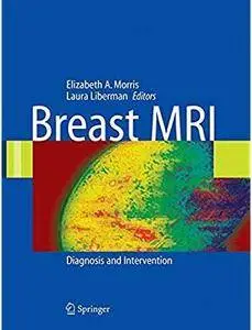 Breast MRI: Diagnosis and Intervention [Repost]