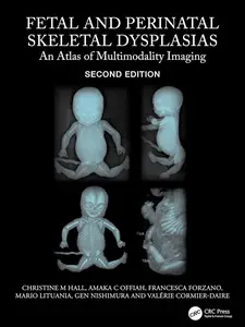 Fetal and Perinatal Skeletal Dysplasias: An Atlas of Multimodality Imaging