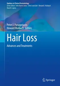 Hair Loss: Advances and Treatments