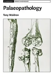 Tony Waldron - Palaeopathology (Cambridge Manuals in Archaeology)