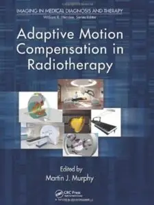 Adaptive Motion Compensation in Radiotherapy