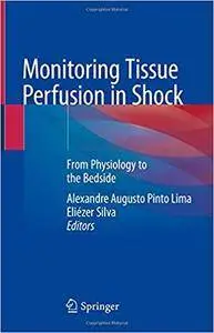 Monitoring Tissue Perfusion in Shock: From Physiology to the Bedside [Repost]