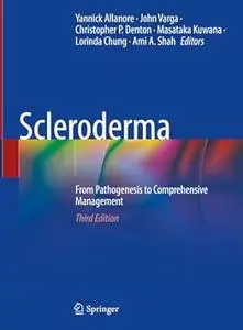 Scleroderma: From Pathogenesis to Comprehensive Management (3rd Edition)