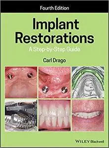 Implant Restorations: A Step-by-Step Guide Ed 4