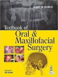 Textbook of Oral and Maxillofacial Surgery